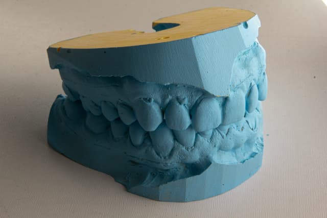 Tratamiento dental Cali