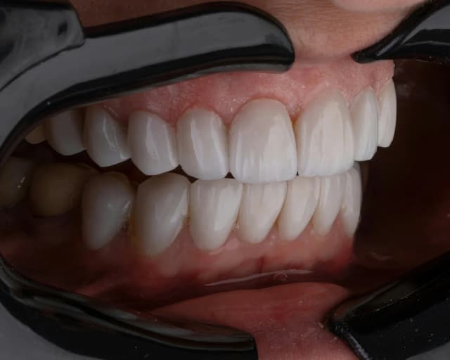 Dental Care Norte Cali