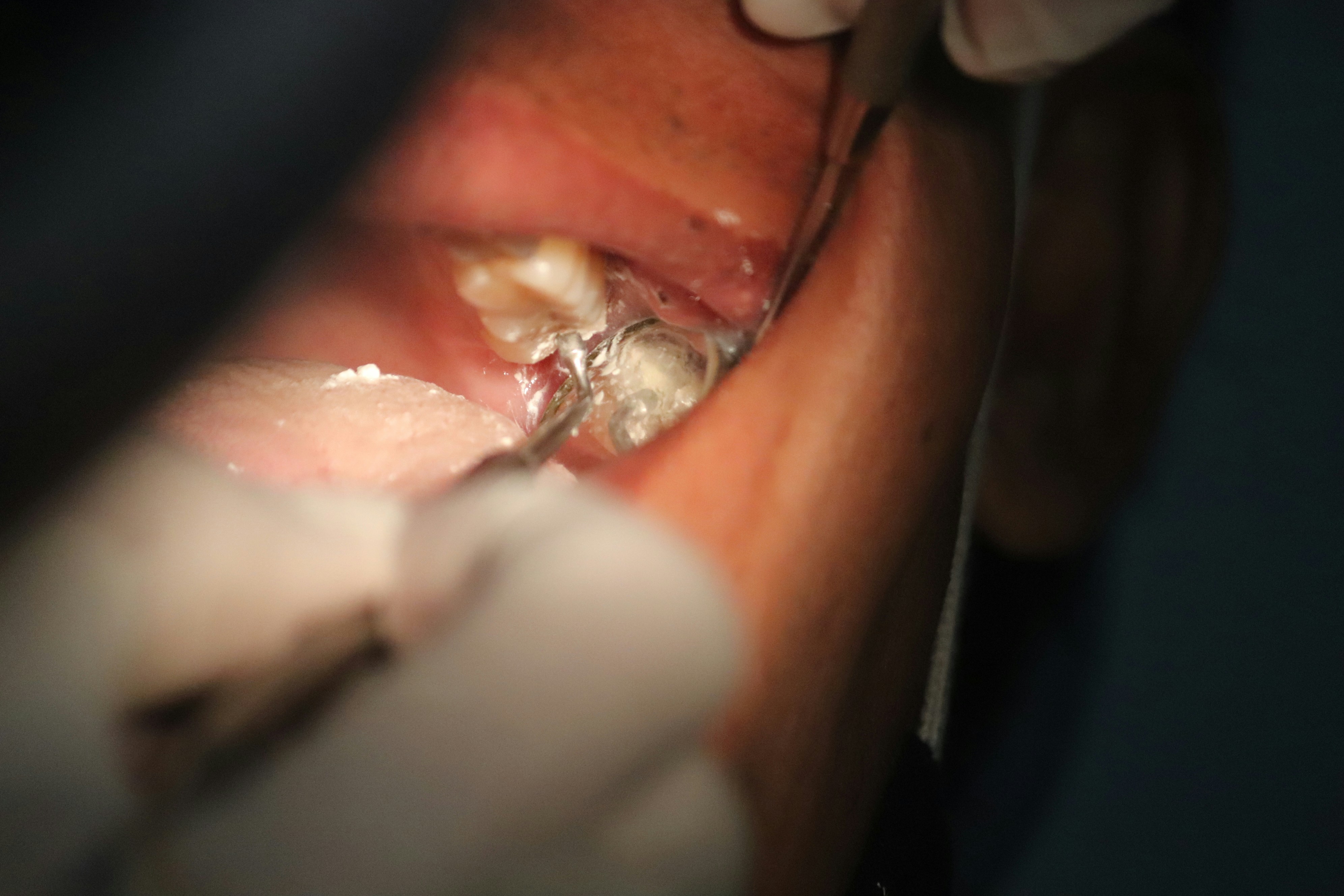 Servicio de cirugia oral en dentalcare