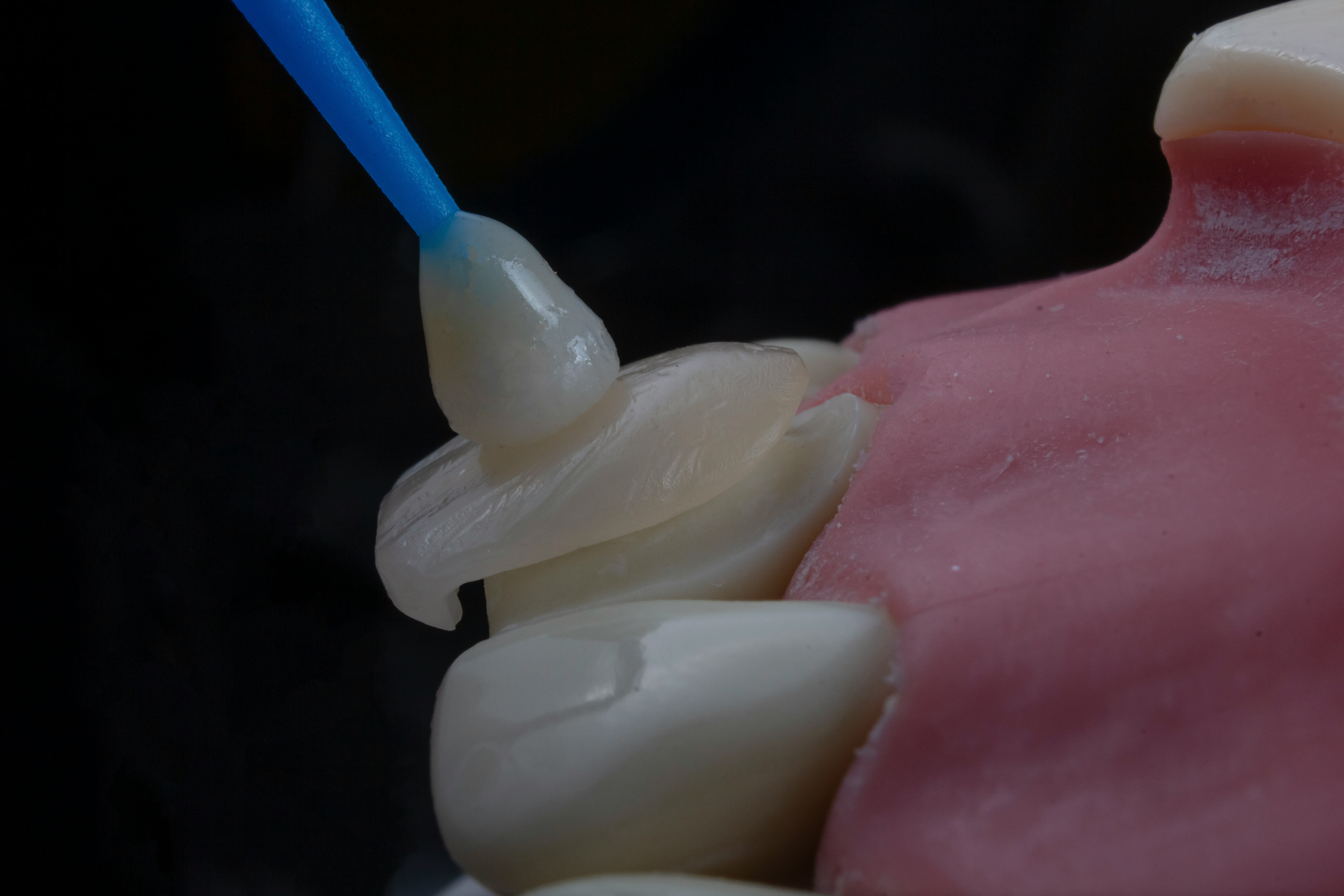 Servicio estetico en dentalcare