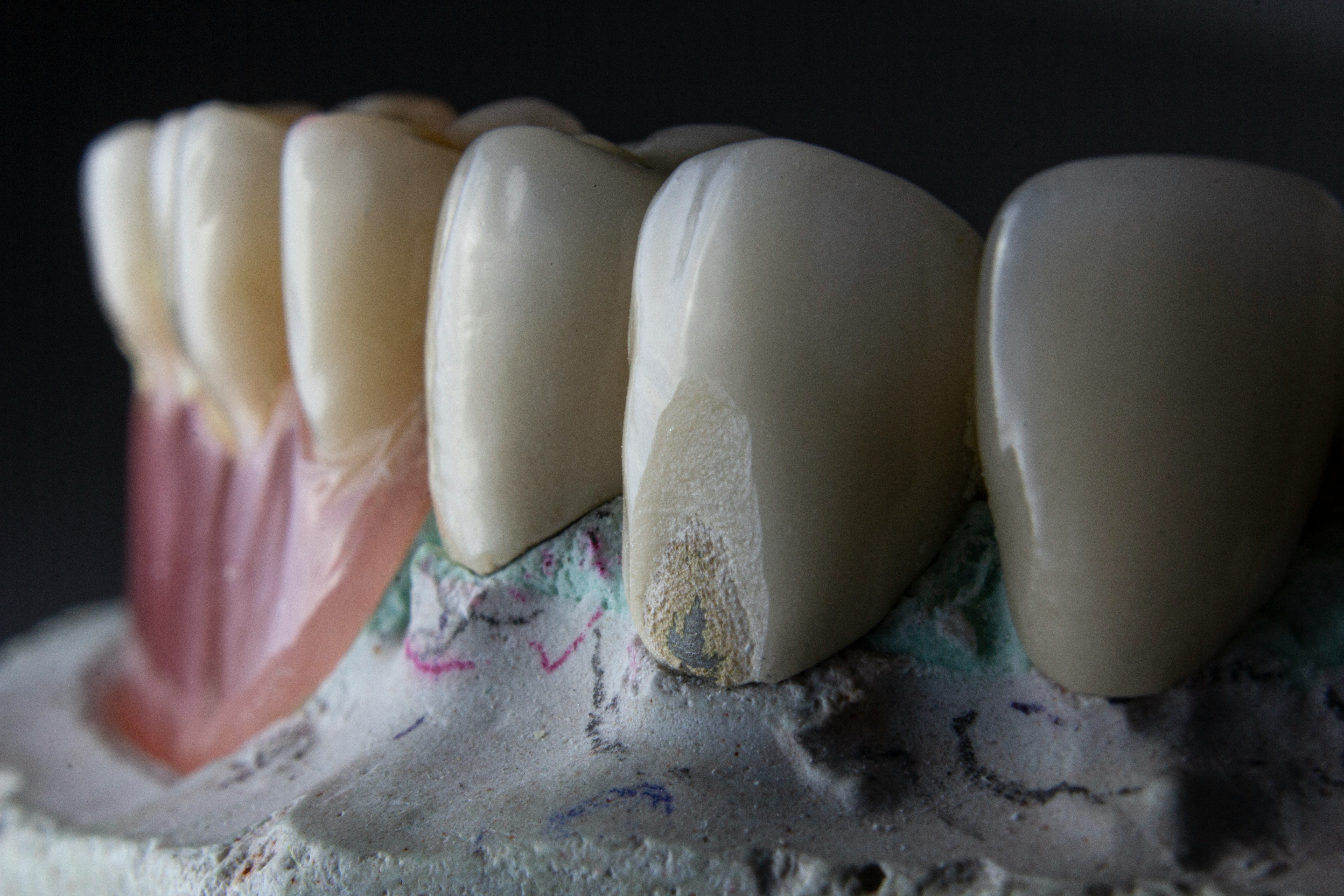 Servicio de periodoncia en dentalcare