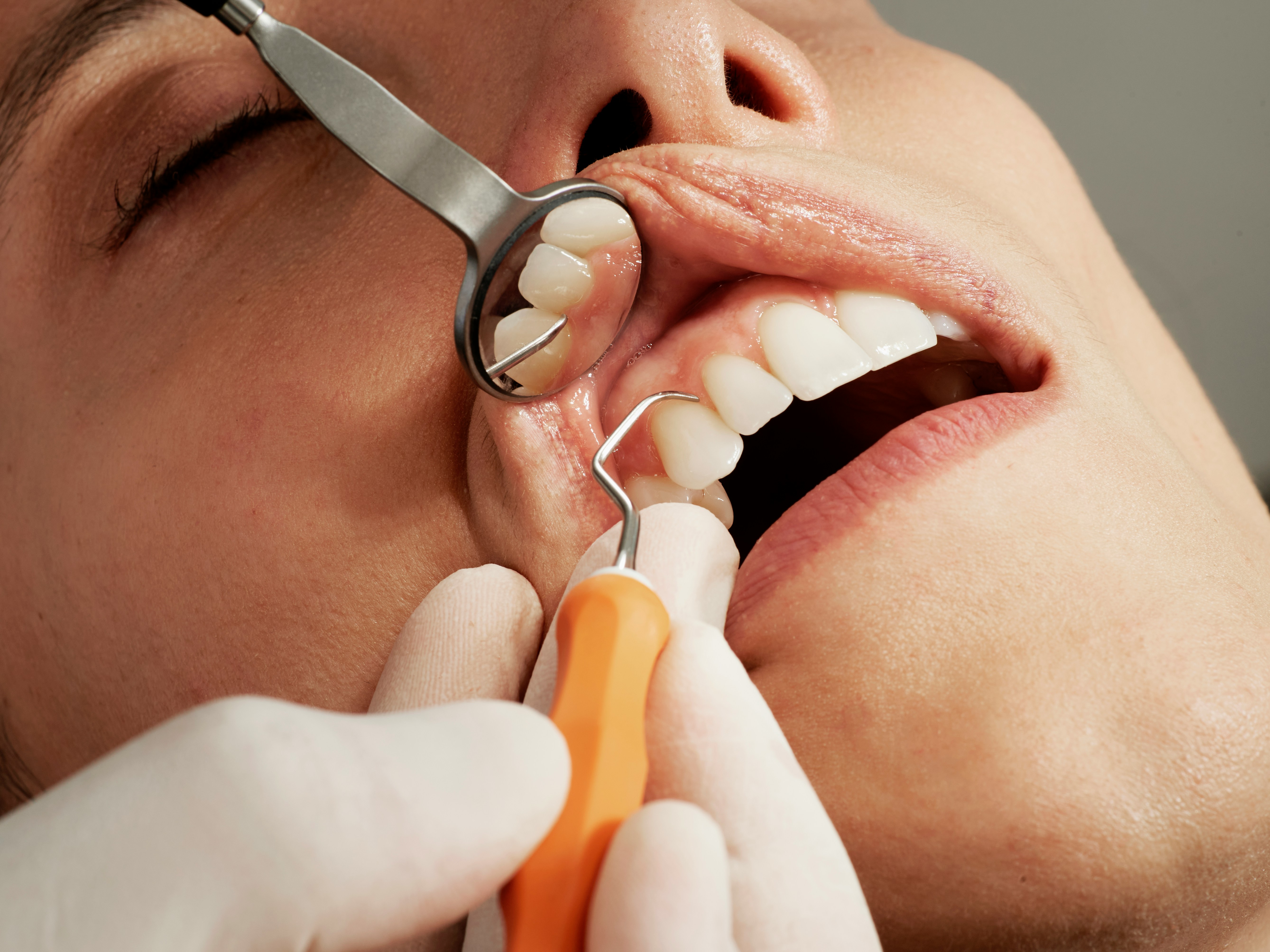 Servicio de promocion y prevencion oral en dentalcare
